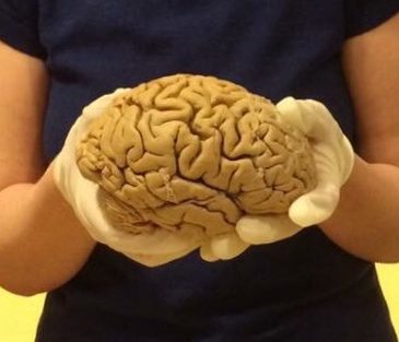 Photo of two hands holding a cadaver brain